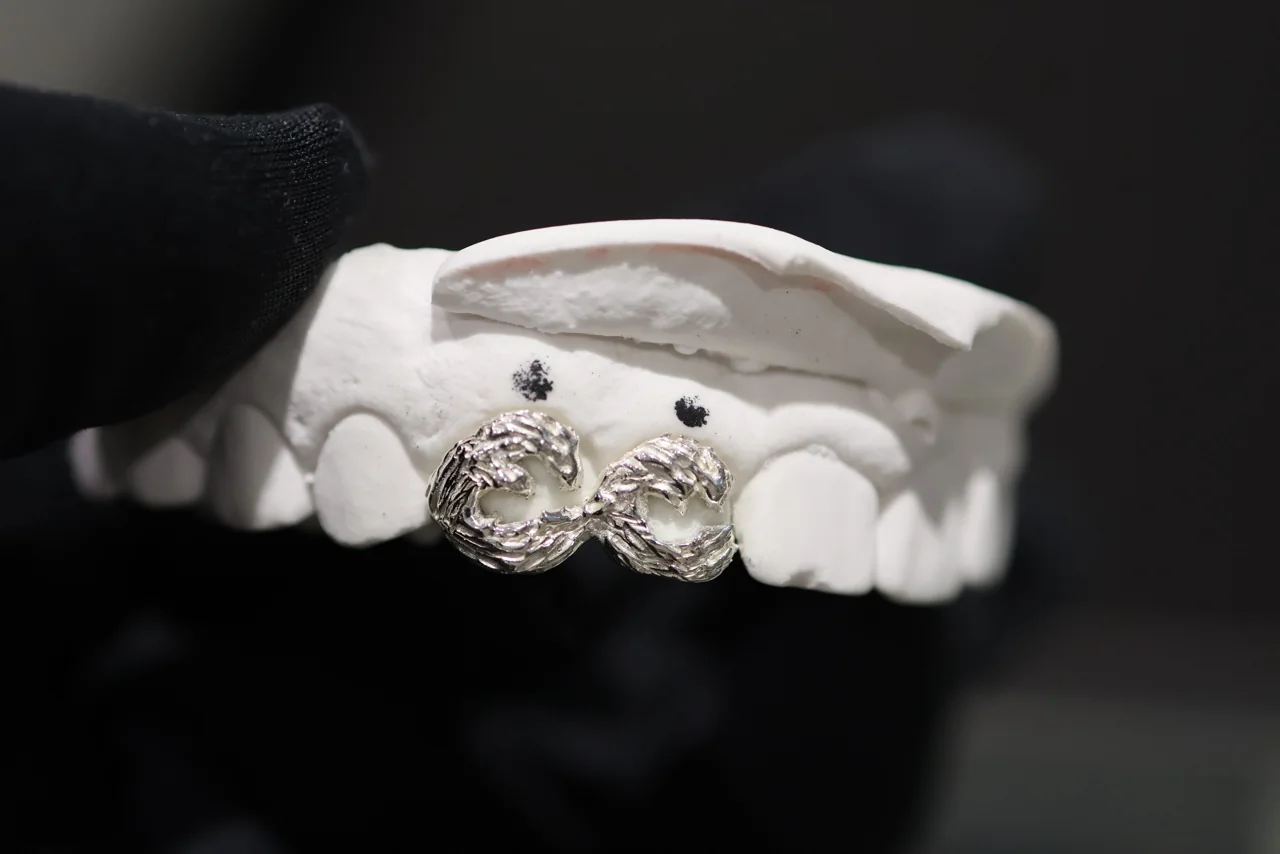 Detailed silver grillz on a dental impression