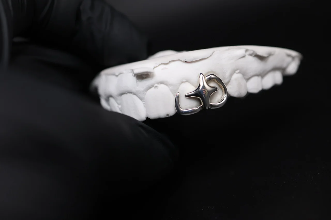Hand-finished silver grillz on a custom dental impression