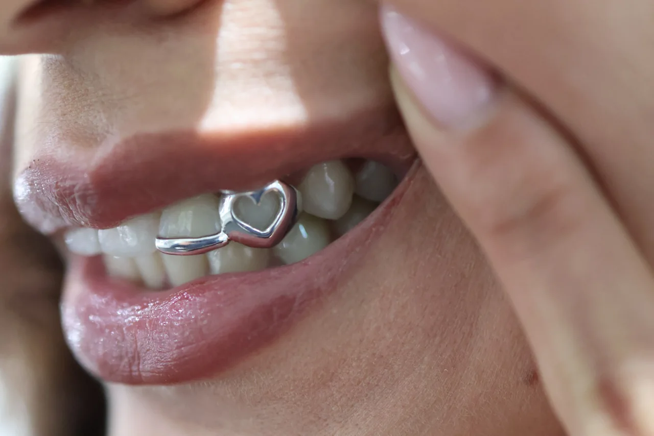 Custom silver heart and open-face grillz being worn