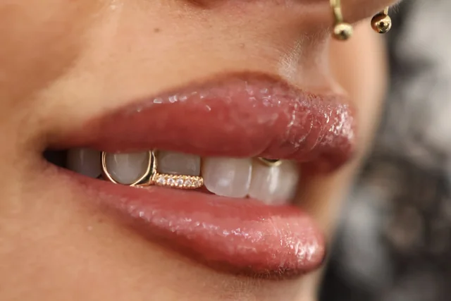 Custom open-face gold grillz