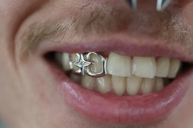 Custom silver star and open-face grillz